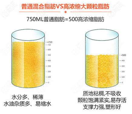 普通脂肪对比高浓缩脂肪