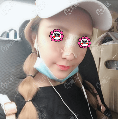 找北京王勋做鼻子有4天了 找北京王勋做鼻子有4天了