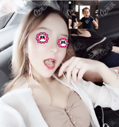 说北京王勋隆鼻好原因是我做的网红风隆鼻效果喜欢呢 说北京王勋隆鼻好原因是我做的网红风隆鼻效果喜欢呢