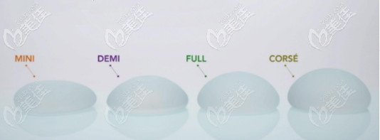 韩国魔滴假体反馈比较高