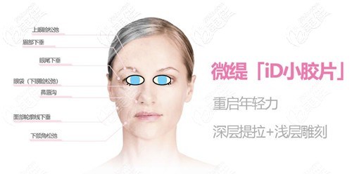 微提id小胶片治疗部位