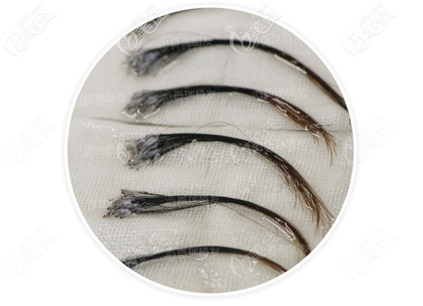 完全不剃发长发种植效果