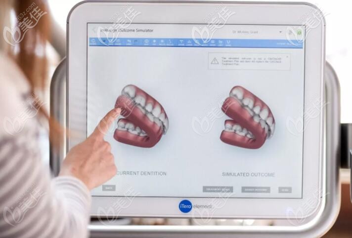 y隐适美黑科技高速