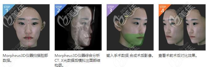 韩国必妩脸骨扫描仪