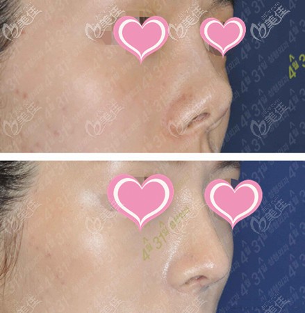 金载勋431鼻部案例