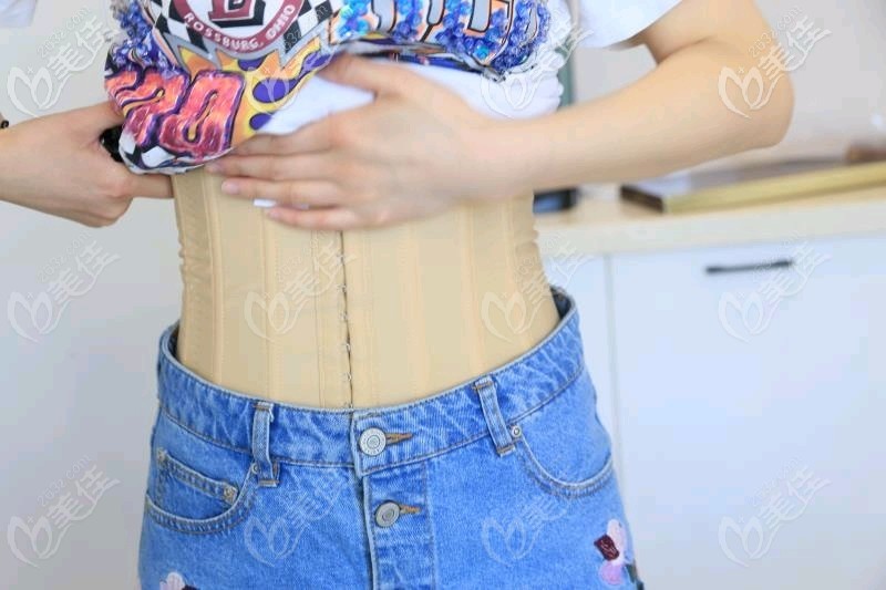 <!--<i data=20240703-sp></i>-->魔力塑腰腹吸脂半个月恢复效果图 <!--<i data=20240703-sp></i>-->魔力塑腰腹吸脂半个月恢复效果图