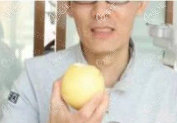 全口种植牙后的效果