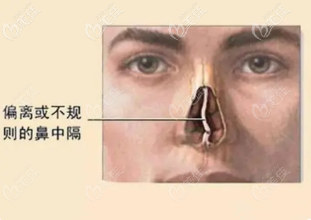 上海薇琳做鼻修复技术高超