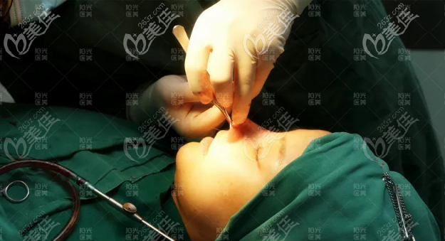 深圳阳光罗志敏隆鼻手术过程图