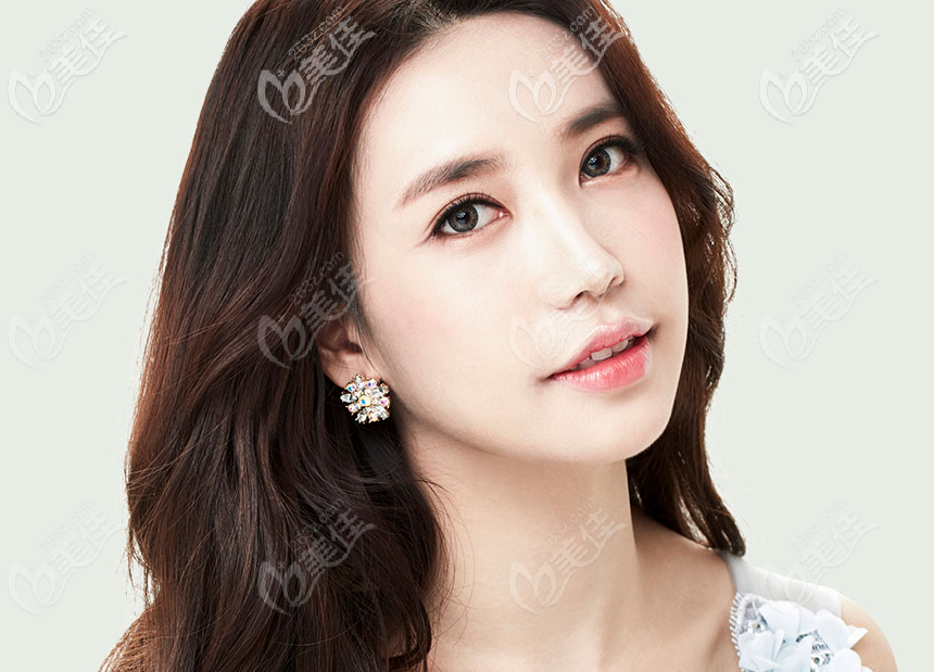 韩国大眼睛整形医院高韩雄做的双眼皮怎么样