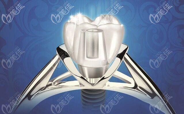 即刻种植牙的适应症和优点 即刻种植牙的适应症和优点