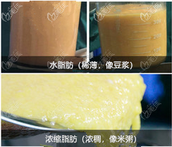 浓缩脂肪示意图 浓缩脂肪示意图