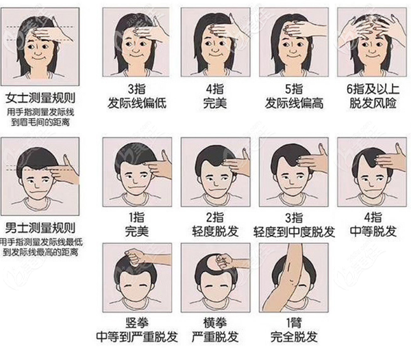 发际线高低自测表 发际线高低自测表