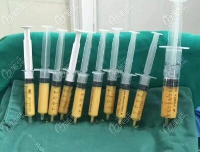 沈阳自体脂肪填充做得好的医生都有谁 沈阳自体脂肪填充做得好的医生都有谁