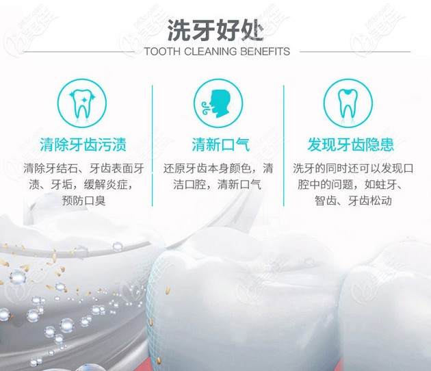 北京劲松口腔洗牙的好处 北京劲松口腔洗牙的好处