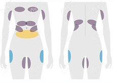 北京新星靓酷塑冷冻溶脂方案个性化