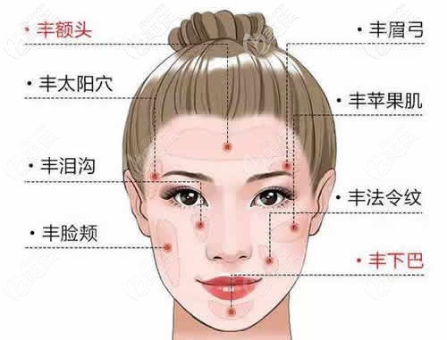 面部脂肪填充的部位分布图