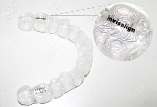 合肥隐适美牙套价格