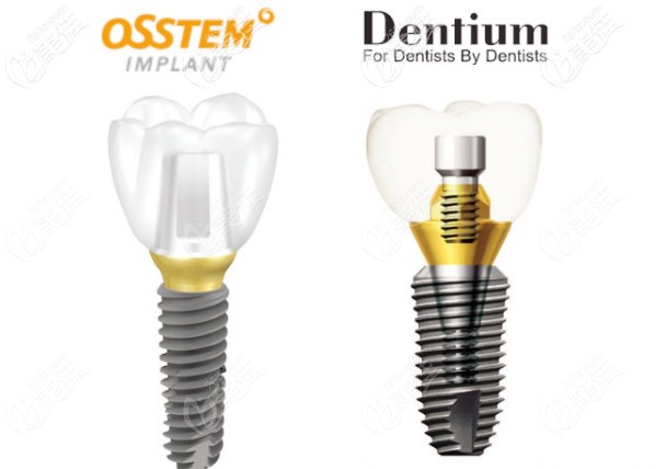 登腾和奥齿泰种植体