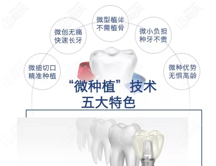 瑞德拥有五大特色种植牙技术优势