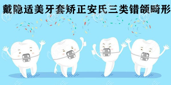 隐形矫正案例 隐形矫正案例