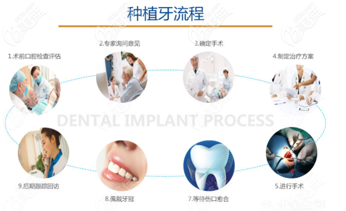 北京圣贝口腔种植牙流程图
