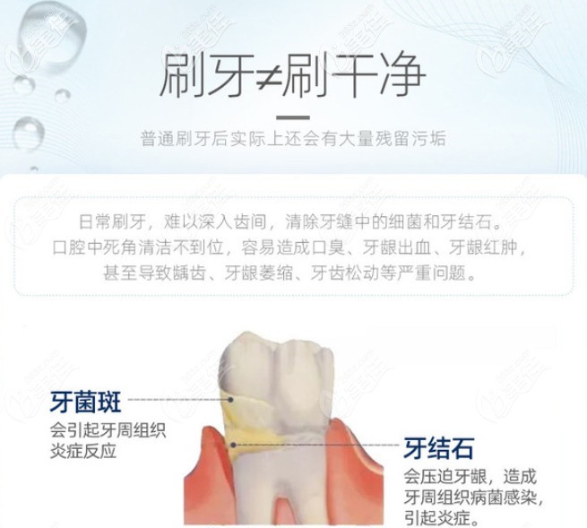 美奥口腔鼓楼院区超声洗牙