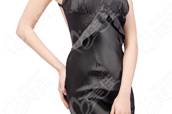 脸部自体脂肪移植