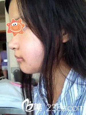 牙齿畸形