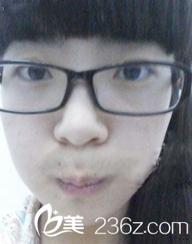 牙齿畸形