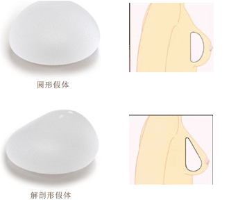 怎样选择适合自己的隆胸假体