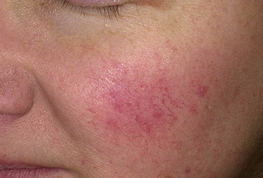 那些尴尬 可又总搞不定的美容题