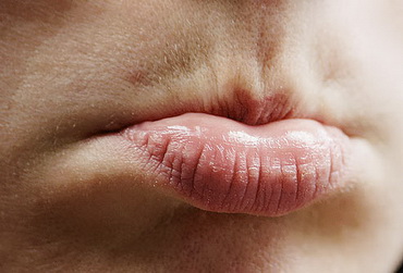 那些尴尬 可又总搞不定的美容题