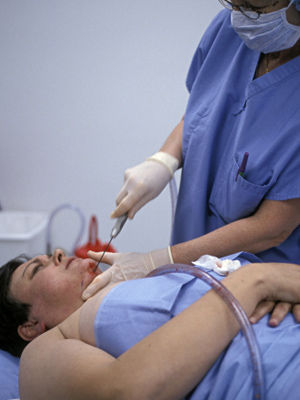 面部吸脂要谨慎 面部吸脂要谨慎