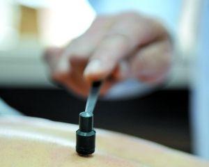 针灸美容轻松解决黄褐斑 让你不再做“班长”