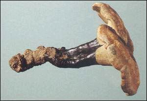 <!--<i data=20240710-sp></i>-->养生除皱必备 较经典的抗衰老抗皱中药