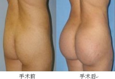 产后妈妈大变身 S曲线毕露无遗