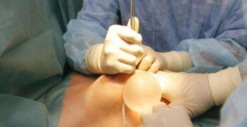 震撼实拍国外美女隆胸手术全过程_最热整形行业新闻话题 - 美佳网