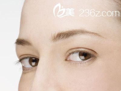 男生割双眼皮和女生割双眼皮又什么区别？