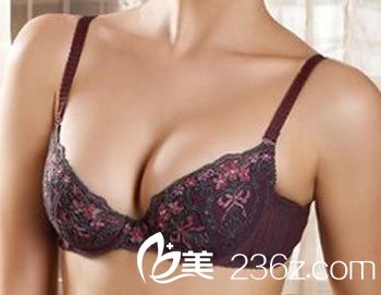 假体隆胸的切口应该如何选择？