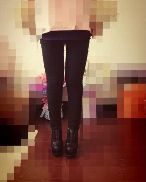 刚做的大腿和臀部吸脂，直接上图啦!!!原来的大肥腿。下午先挂