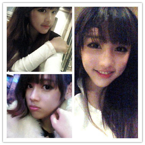 变美体验,整形体验,整形案例,整形项目,热门整形案例术前照片1