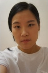 变美体验,整形体验,整形案例,整形项目,热门整形案例术前照片1