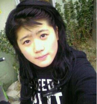 变美体验,整形体验,整形案例,整形项目,热门整形案例术前照片1