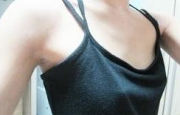 变美体验,整形体验,整形案例,整形项目,热门整形案例术前照片1