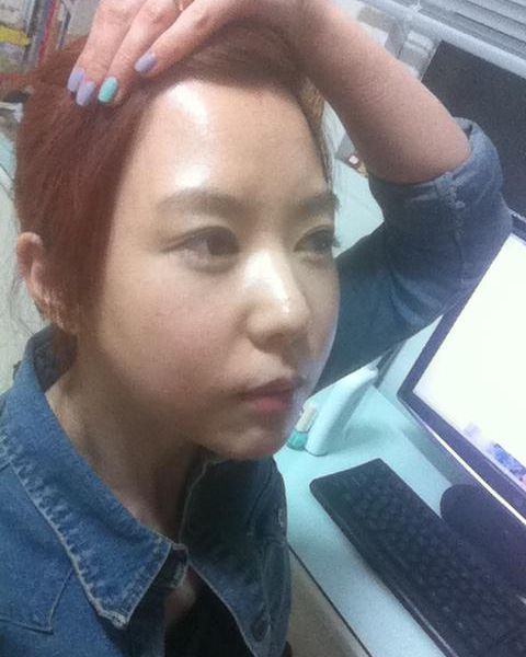 变美体验,整形体验,整形案例,整形项目,热门整形案例术前照片1