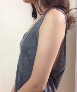 整形专家术前照片3