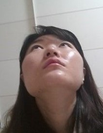 变美体验,整形体验,整形案例,整形项目,热门整形案例术前照片1