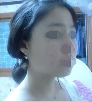 整形医院术前照片2